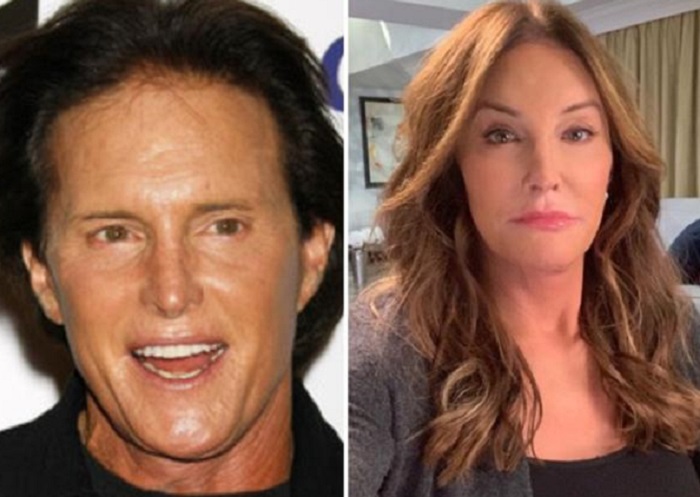 Caitlyn Jenner svela a quali interventi di chirurgia estetica si è sottoposta per diventare più femminile