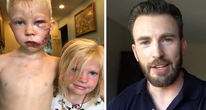 Chris Evans fa un video per Bridger, che ha salvato la sorella dall’attacco dei cani: “Sei un eroe”