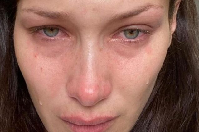 “Soffro di ansia e depressione”, le lacrime di Bella Hadid sui social