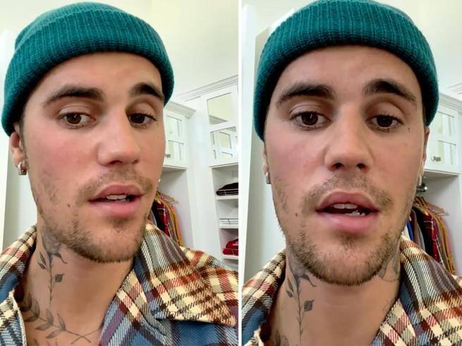 Justin Bieber torna a sorridere dopo la diagnosi della sindrome di Ramsay Hunt